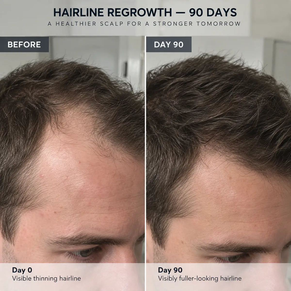 Peptide Infusion  Hair Regrowth Serum